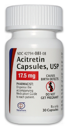 Acitretin Capsules, USP (17.5 mg)